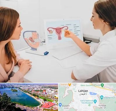 فوق تخصص نازایی در لاهیجان