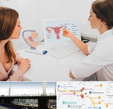 فوق تخصص نازایی در پارک وی