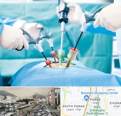 دکتر لاپاراسکوپی در پونک