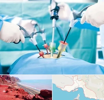 دکتر لاپاراسکوپی در هرمزگان