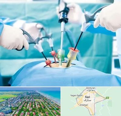 دکتر لاپاراسکوپی در ساری