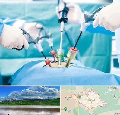 دکتر لاپاراسکوپی در مرند