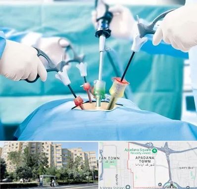 دکتر لاپاراسکوپی در آپادانا