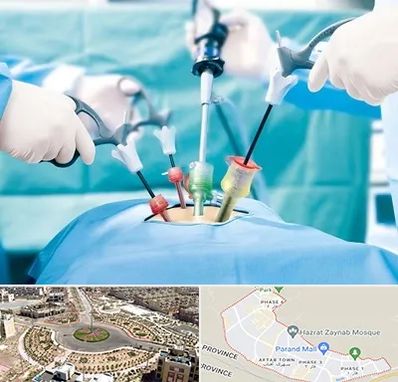 دکتر لاپاراسکوپی در پرند