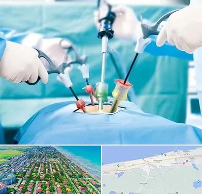 دکتر لاپاراسکوپی در فریدونکنار