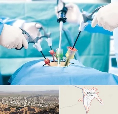 دکتر لاپاراسکوپی در اسفراین