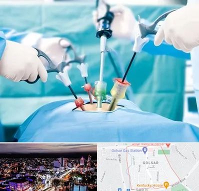 دکتر لاپاراسکوپی در گلسار رشت