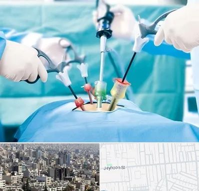 دکتر لاپاراسکوپی در جیحون