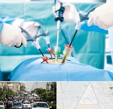 دکتر لاپاراسکوپی در سیدی مشهد