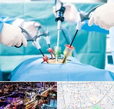 دکتر لاپاراسکوپی در منظریه رشت