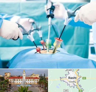 دکتر لاپاراسکوپی در رشت