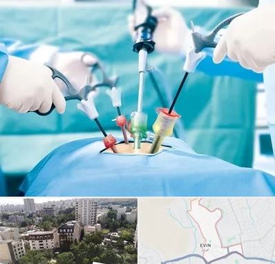 دکتر لاپاراسکوپی در اوین