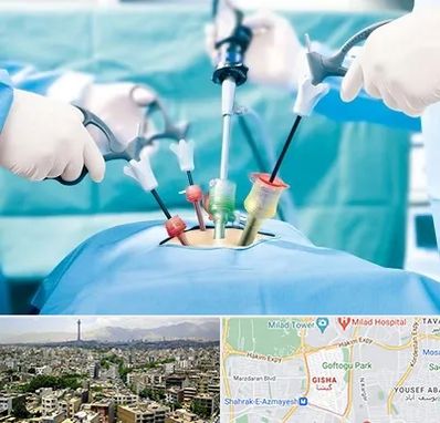 دکتر لاپاراسکوپی در گیشا