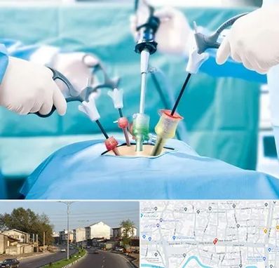 دکتر لاپاراسکوپی در ضیابری رشت