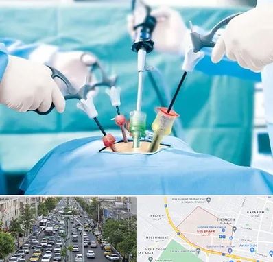 دکتر لاپاراسکوپی در گلشهر کرج