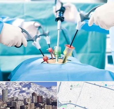 دکتر لاپاراسکوپی در ازگل