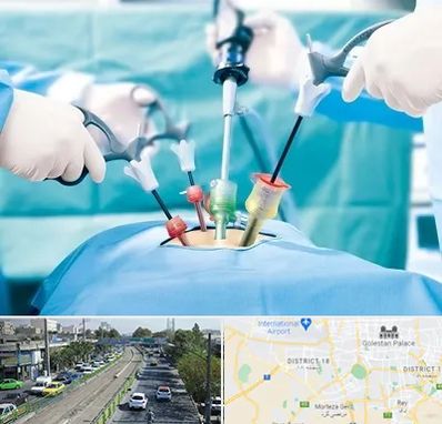 دکتر لاپاراسکوپی در جنوب تهران