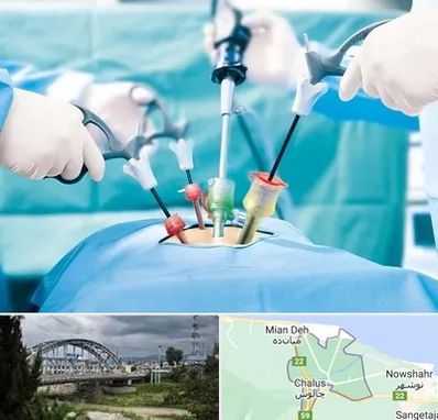 دکتر لاپاراسکوپی در چالوس