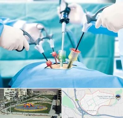 دکتر لاپاراسکوپی در مرزداران تبریز