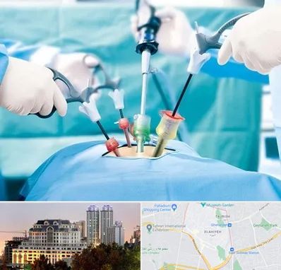 دکتر لاپاراسکوپی در فرشته