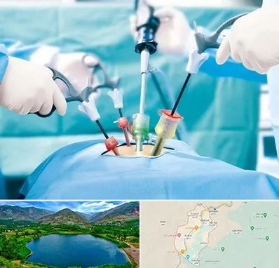 دکتر لاپاراسکوپی در رودبار