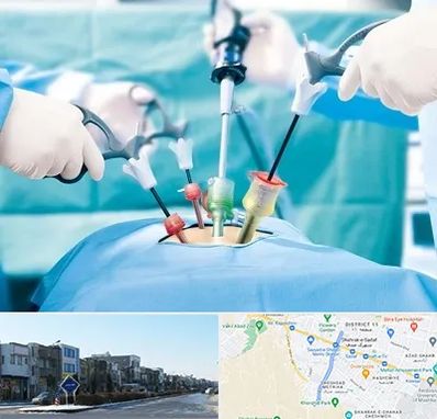 دکتر لاپاراسکوپی در شریعتی مشهد