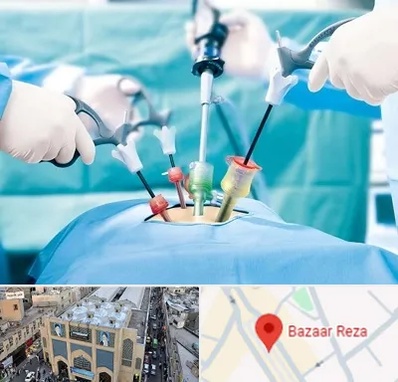 دکتر لاپاراسکوپی در بازار رضا مشهد