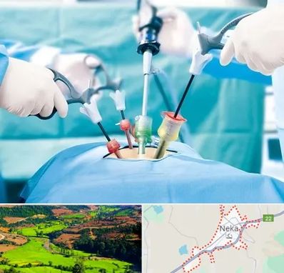دکتر لاپاراسکوپی در نکا