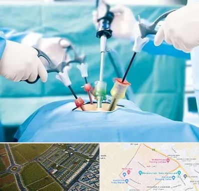 دکتر لاپاراسکوپی در الهیه مشهد