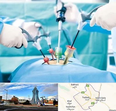 دکتر لاپاراسکوپی در تایباد