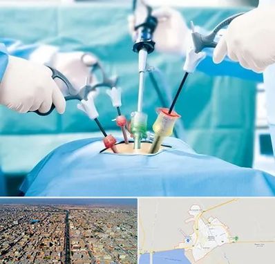 دکتر لاپاراسکوپی در بندر ماهشهر