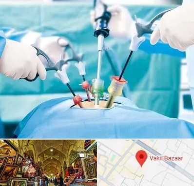 دکتر لاپاراسکوپی در بازار وکیل شیراز