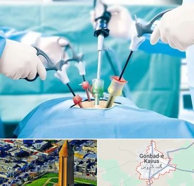دکتر لاپاراسکوپی در گنبد کاووس