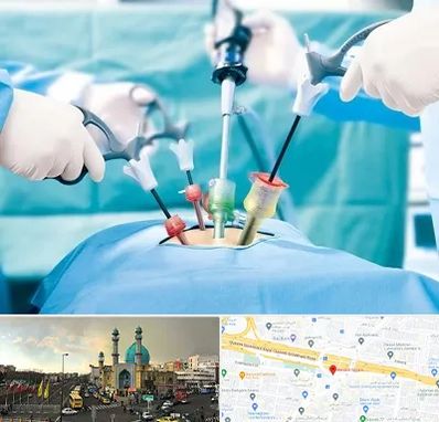 دکتر لاپاراسکوپی در رسالت