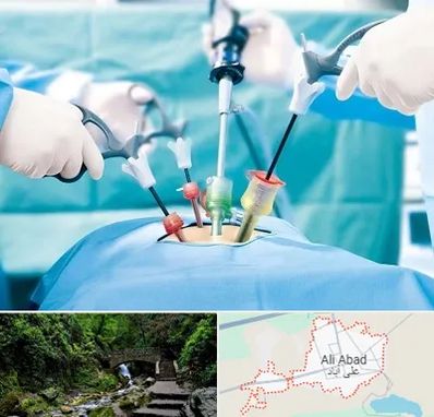 دکتر لاپاراسکوپی در علی آباد کتول