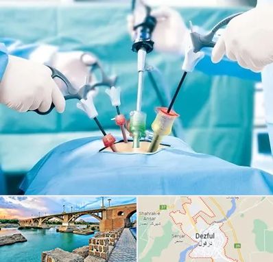 دکتر لاپاراسکوپی در دزفول