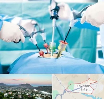 دکتر لاپاراسکوپی در لواسان