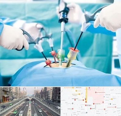 دکتر لاپاراسکوپی در توحید