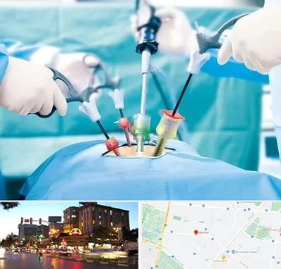 دکتر لاپاراسکوپی در بلوار سجاد مشهد