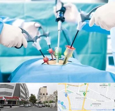 دکتر لاپاراسکوپی در بلوار فردوس