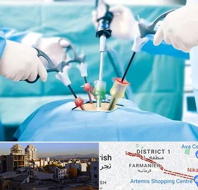 دکتر لاپاراسکوپی در فرمانیه