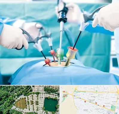 دکتر لاپاراسکوپی در وکیل آباد مشهد