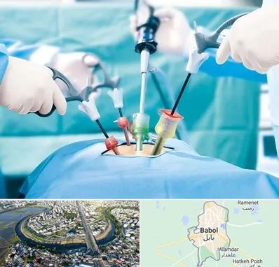 دکتر لاپاراسکوپی در بابل