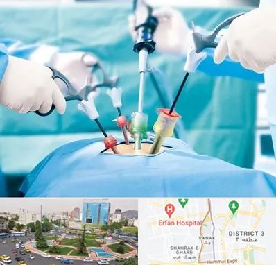 دکتر لاپاراسکوپی در ونک