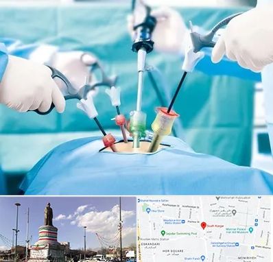 دکتر لاپاراسکوپی در کارگر جنوبی