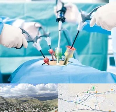 دکتر لاپاراسکوپی در رودهن