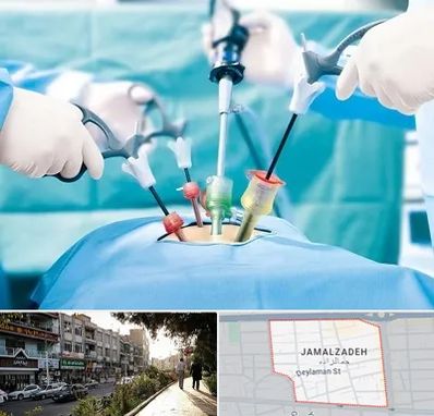 دکتر لاپاراسکوپی در خیابان جمالزاده