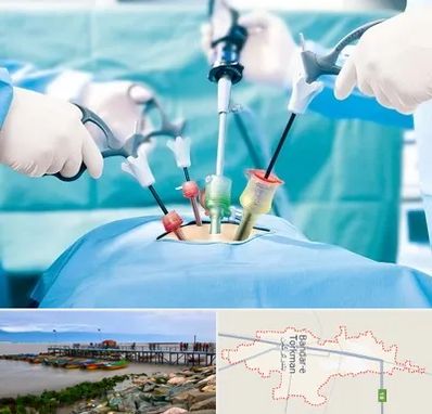 دکتر لاپاراسکوپی در بندر ترکمن