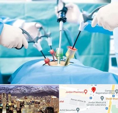 دکتر لاپاراسکوپی در جردن