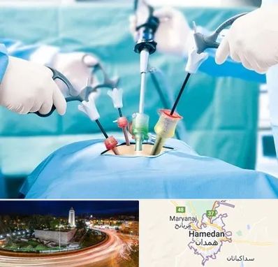 دکتر لاپاراسکوپی در همدان